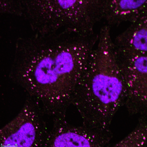 Cette image montre une cellule exposée à un stress oxydatif. Des granules de stress se forment dans le cytoplasme (en violet). La protéine TDP-43 contrôle la taille des granules de stress par la régulation d’une autre protéine nommée G3BP1.