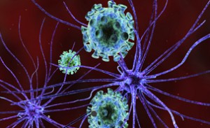 thinkstock-sclerose-en-plaques