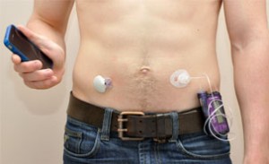 ircm_pancreasartificiel